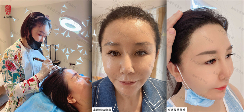 1663739336127765.jpg 发际线 微信图片_20220921133515.jpg