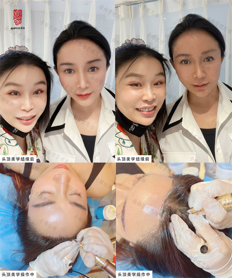 1663739344180955.jpg 发际线 微信图片_20220921133547.jpg